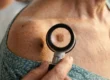 A macro close-up composition illuminated by warm, directional golden hour light from the left, highlighting the sharp texture of the skin. A dermatologist's hand holds a black and silver dermatoscope against a patient's shoulder. The instrument's circular lens sharply magnifies a brown mole in the center of the frame. A shallow depth of field softly blurs the patient's teal patterned gown and the surrounding environment, drawing immediate focus to the illuminated diagnostic tool.